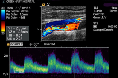 Overview of Vascular Centre Service