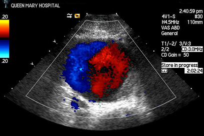 Overview of Vascular Centre Service